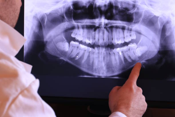 Best Broken or Chipped Tooth Repair in Utica, SC